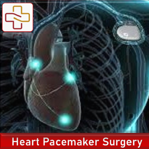 Heart Pacemaker - ICD Implant Surgery in India - CMCS health.